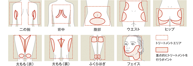 トリートメント部位